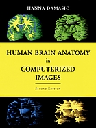 Human brain anatomy in computerized images