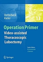 Video-assisted thoracoscopic lobectomy