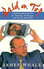 Bald on top : a light-headed guide for the thinning, the rugged -- and the just plain bald