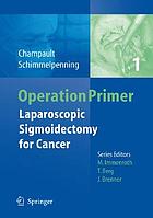 Laparoscopic sigmoidectomy for cancer