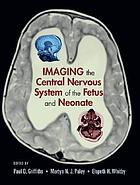 Imaging the central nervous system of the fetus and neonate