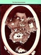 The poet assassinated