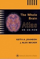 The whole brain atlas on CD-ROM