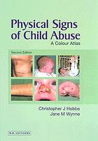 Physical signs of child abuse
