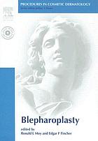 Blepharoplasty