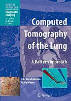 Computed tomography of the lung : a pattern approach