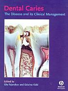 Dental caries
