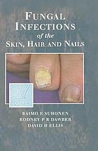 Fungal infections of the skin, hair, and nails