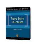 Tibial shaft fractures