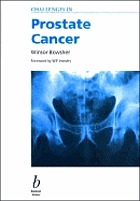 Challenges in prostate cancer