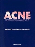 Acne : diagnosis and management