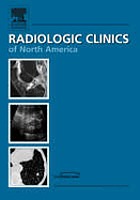 Postoperative musculoskeletal imaging
