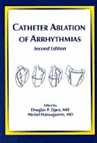 Catheter ablation of arrhythmias