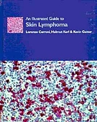 An illustrated guide to skin lymphoma