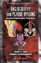 Angiography and plaque imaging : advanced segmentation techniques