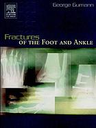 Fractures of the foot and ankle