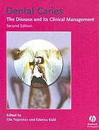 Dental caries : the disease and its clinical management