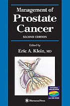 Management of prostate cancer
