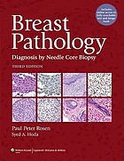 Breast pathology : diagnosis by needle core biopsy