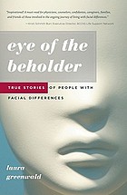 Eye of the beholder : true stories of people with facial differences