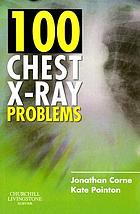100 chest X-ray problems
