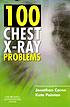 100 chest X-ray problems