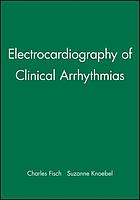 Electrocardiography of clinical arrhythmias
