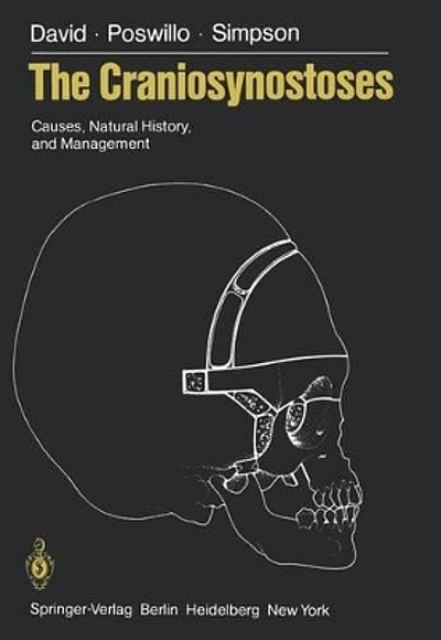 The craniosynostoses : causes, natural history, and management ...