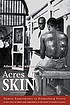 Acres of skin : human experiments at Holmesburg... by Allen M Hornblum