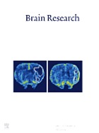 Brain research : international multidisciplinary journal devoted to fundamental research in the brain sciences.