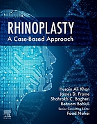 Rhinoplasty