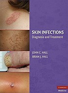 Skin Infections: Diagnosis & Treatment