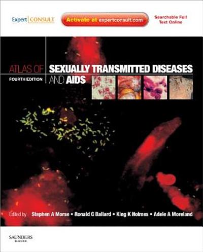Atlas of sexually transmitted diseases and AIDS | WorldCat.org