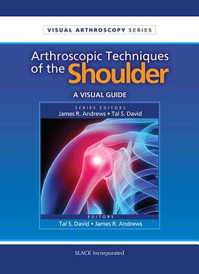 Arthroscopic techniques of the shoulder : a visual guide | WorldCat.org