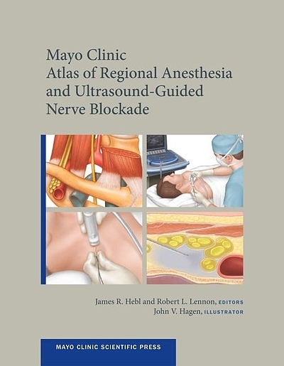 Sciatic nerve - Mayo Clinic