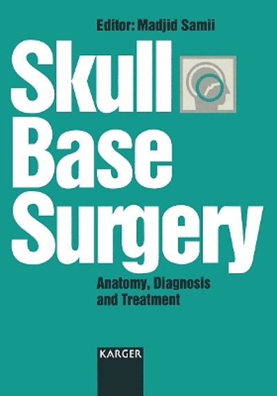 Skull Base Surgery : Anatomy, Diagnosis And Treatment 